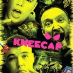 Kneecap